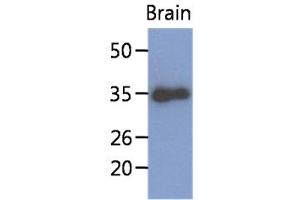 The extract of mouse brain (40ug) were resolved by SDS-PAGE, transferred to PVDF membrane and probed with anti-human KLF7 antibody (1:1000). (KLF7 抗体)