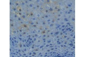 Used in DAB staining on fromalin fixed paraffin- embedded liver tissue (NR1H2 抗体  (AA 1-446))