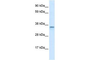WB Suggested Anti-CGI-62 Antibody Titration:  1. (FAM164A 抗体  (C-Term))