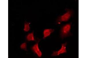 ABIN6275172 staining HeLa by IF/ICC. (RRAD 抗体  (Internal Region))