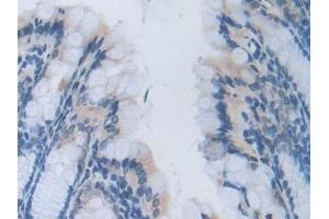 Detection of HPSE in Mouse Colon Tissue using Polyclonal Antibody to Heparanase (HPSE)