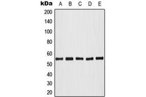Western blot analysis of AKT (pT308) expression in HeLa colchicine-treated (A), HL60 (B), NIH3T3 (C), SP2/0 colchicine-treated (D), PC12 colchicine-treated (E) whole cell lysates. (AKT1 抗体  (pSer308))