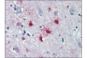 Human Brain, cortex: Formalin-Fixed, Paraffin-Embedded (FFPE) (alpha 1 Adrenergic Receptor 抗体  (AA 206-270))