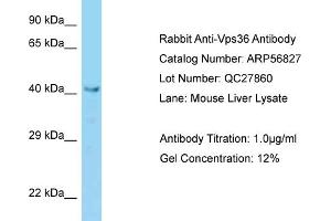 Western Blotting (WB) image for anti-Vacuolar Protein Sorting 36 (VPS36) (N-Term) antibody (ABIN2786923)