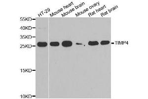 Western blot analysis of extracts of various cell lines, using TIMP4 antibody. (TIMP4 抗体  (AA 30-224))