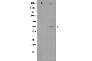 Western blot analysis of K562 whole cell lysates, using PTPN2 Antibody. (PTPN2 抗体  (C-Term))
