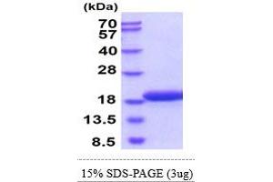 SDS-PAGE (SDS) image for Synuclein, gamma (Breast Cancer-Specific Protein 1) (SNCG) (AA 1-123) protein (His tag) (ABIN7281290) (SNCG Protein (AA 1-123) (His tag))