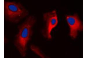 Immunofluorescent analysis of MAST3 staining in HepG2 cells. (MAST3 抗体  (C-Term))
