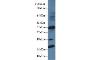 Detection of IGFBP1 in Human Placenta lysate using Polyclonal Antibody to Insulin Like Growth Factor Binding Protein 1 (IGFBP1) (IGFBPI 抗体  (AA 112-262))