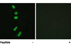 Immunofluorescence analysis of HeLa cells, using SF1 polyclonal antibody . (Splicing Factor 1 抗体)