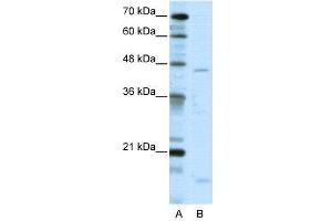 WB Suggested Anti-TRIP13  Antibody Titration: 5. (TRIP13 抗体  (C-Term))