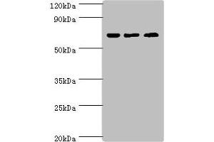 Western blot All lanes: PIAS2 antibody at 2 μg/mL Lane 1: A431 whole cell lysate Lane 2: HepG2 whole cell lysate Lane 3: Mouse brain tissue Secondary Goat polyclonal to rabbit IgG at 1/10000 dilution Predicted band size: 69, 64, 46 kDa Observed band size: 69 kDa