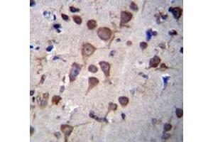 Immunohistochemistry (Paraffin-embedded Sections) (IHC (p)) image for anti-Phosphatidylinositol Glycan Anchor Biosynthesis, Class A (PIGA) (AA 147-177), (C-Term) antibody (ABIN954134)