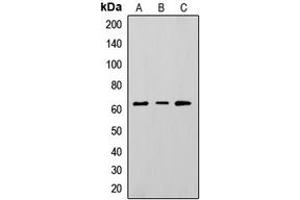 Western blot analysis of CD73 expression in HepG2 (A), K562 (B), A375 (C) whole cell lysates. (CD73 抗体  (Center))