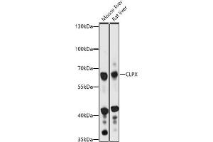 Western blot analysis of extracts of various cell lines, using CLPX antibody (ABIN7266418) at 1:1000 dilution. (CLPX 抗体  (AA 500-600))