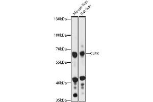 Western blot analysis of extracts of various cell lines, using CLPX antibody (ABIN7266418) at 1:1000 dilution.