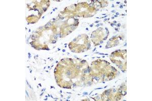 Immunohistochemistry of paraffin-embedded human stomach using NOTCH2 antibody. (NOTCH2 抗体)