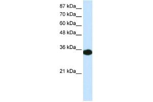 WB Suggested Anti-HOXD4 Antibody Titration: 0. (HOXD4 抗体  (C-Term))