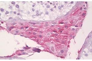 Anti-SAA4 antibody IHC staining of human testis, Leydig cells. (SAA4 抗体  (AA 81-130))