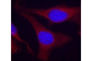 Immunofluorescence staining of methanol-fixed HeLa cells using Phospho-PTPN6-Y536 antibody (ABIN2988271). (SHP1 抗体  (pTyr536))