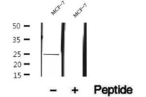 Western blot analysis of extracts of MCF-7 cells, using UQCRFS1 antibody. (UQCRFS1 抗体  (C-Term))