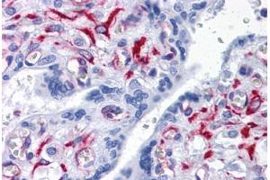 Human Placenta: Formalin-Fixed, Paraffin-Embedded (FFPE) (SLC44A2 抗体  (AA 123-231))
