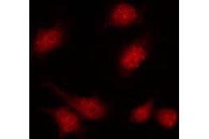 Immunofluorescence (fixed cells) (IF/ICC) image for anti-Phosphatidylinositol-4-Phosphate 5-Kinase, Type I, gamma (PIP5K1C) (Internal Region) antibody (ABIN6258304)