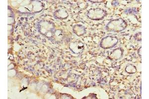 Immunohistochemistry of paraffin-embedded human small intestine tissue using ABIN7165103 at dilution of 1:100 (ARMCX6 抗体  (AA 28-300))