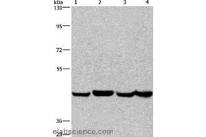 Western blot analysis of A549, Hela, PC3 and HepG2 cell, using RBMY1A1 Polyclonal Antibody at dilution of 1:350 (RBMY1A1 抗体)