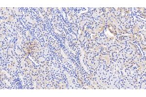 Immunohistochemistry (IHC) image for anti-Sodium Channel, Nonvoltage-Gated 1 alpha (SCNN1A) (AA 112-543) antibody (ABIN7435487)