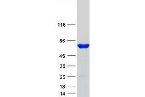Western Blotting (WB) image for 6-phosphofructo-2-Kinase/fructose-2,6-Biphosphatase 1 (PFKFB1) protein (Myc-DYKDDDDK Tag) (ABIN2728745)