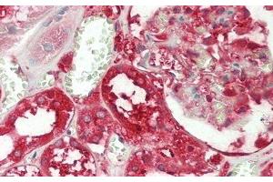 Immunohistochemistry (IHC) image for anti-Glutathione S-Transferase pi 1 (GSTP1) (AA 1-210) antibody (ABIN7433147)