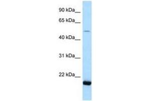 Image no. 1 for anti-seryl-tRNA Synthetase 2, Mitochondrial (SARS2) (AA 108-157) antibody (ABIN6747848) (SARS2 抗体  (AA 108-157))