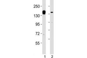 Western blot testing of KDM6A antibody at 1:2000 dilution. (KDM6A 抗体  (AA 1041-1074))