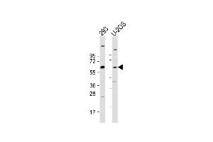 All lanes : Anti-TRIM6 Antibody (N-term) at 1:2000 dilution Lane 1: 293 whole cell lysate Lane 2: U-2OS whole cell lysate Lysates/proteins at 20 μg per lane. (TRIM6 抗体  (N-Term))