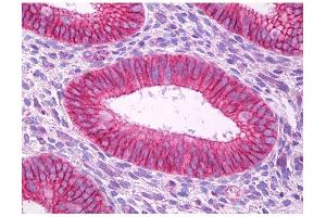 Image no. 1 for anti-Potassium Voltage-Gated Channel, Shaker-Related Subfamily, Member 5 (KCNA5) (C-Term) antibody (ABIN347243)