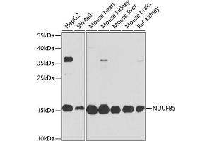 Western blot analysis of extracts of various cell lines, using NDUFB5 antibody  at 1:1000 dilution. (NDUFB5 抗体  (AA 100-189))