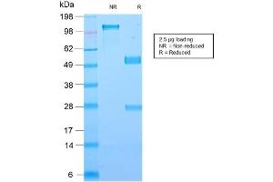 SDS-PAGE Analysis of Purified Galectin-1 Rabbit Recombinant Monoclonal Antibody ABIN6383867.