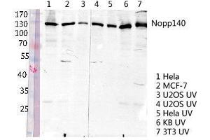 Western Blot (WB) analysis of specific lysis using Nopp140 Polyclonal Antibody. (NOLC1 抗体  (C-Term))