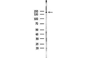 anti-Myosin XVI (MYO16) (Internal Region) antibody