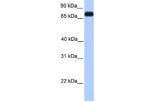 WB Suggested Anti-PRICKLE3 Antibody Titration:  0. (PRICKLE3 抗体  (C-Term))