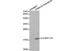 Western blot analysis of extracts from 293 cells, using Phospho-STMN1-S16 antibody. (Stathmin 1 抗体  (pSer16))