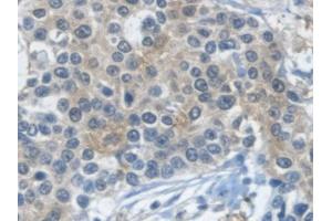 Immunohistochemistry (IHC) image for anti-Glyceraldehyde-3-Phosphate Dehydrogenase (GAPDH) (AA 2-148) antibody (ABIN7426391)