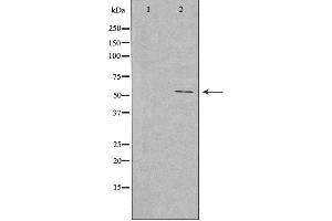 Western blot analysis of extracts from rat lung cells, using EFEMP1 antibody. (FBLN3 抗体  (Internal Region))