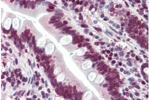 Human Small Intestine (formalin-fixed, paraffin-embedded) stained with LASS6 antibody ABIN396945 at 5 ug/ml followed by biotinylated goat anti-rabbit IgG secondary antibody ABIN481713, alkaline phosphatase-streptavidin and chromogen. (CERS6 抗体  (N-Term))