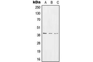 Western blot analysis of RPC expression in HeLa (A), NIH3T3 (B), rat stomach (C) whole cell lysates.