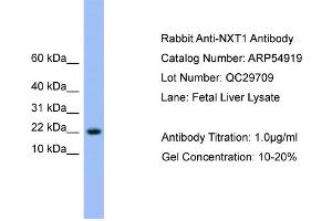WB Suggested Anti-NXT1  Antibody Titration: 0.