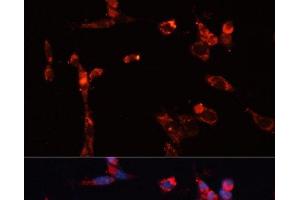 Immunofluorescence analysis of NIH/3T3 cells using MMP16 Polyclonal Antibody at dilution of 1:100. (MMP16 抗体)