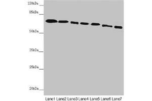 Western blot All lanes: DYNC1I1 antibody at 2. (DYNC1I1 抗体  (AA 1-220))