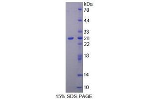 SDS-PAGE analysis of Rat Keratin 1 Protein. (Cytokeratin 1 蛋白)